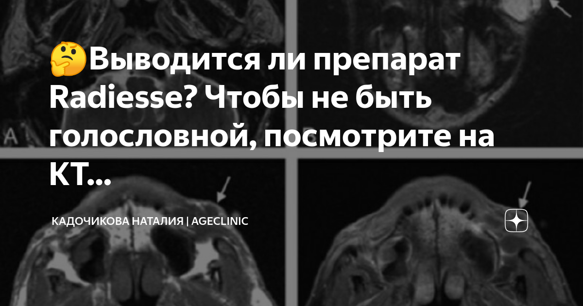 результаты кт. кт легких заключение. результаты кт легких. кто делал кт отзывы. магнитно-резонансный томограф "simens open viva".