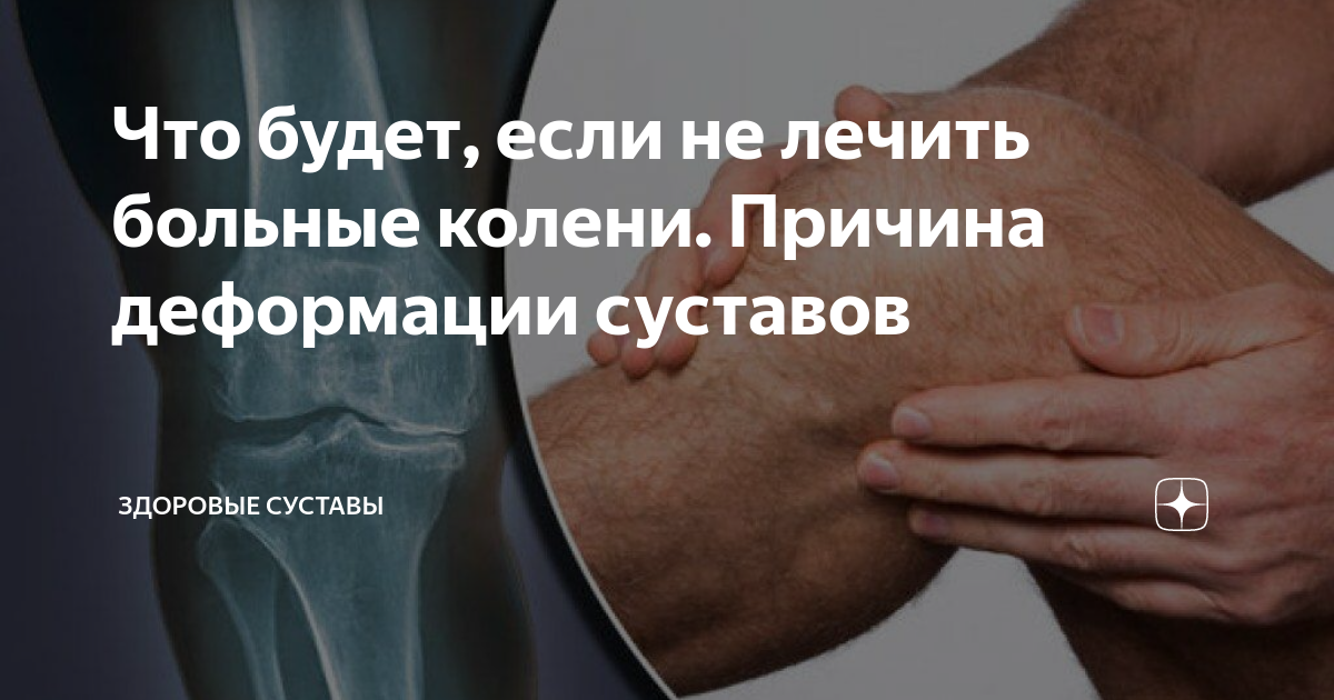 Суставы щелкают причины. Почему щелкают суставы: разбор причины щелчков и их природы Хрустят суставы, в чём может быть причина? Фролов Ю.А. - YouTube Киста Коленного Сустава Лечение Народное — Buy-artox.ru