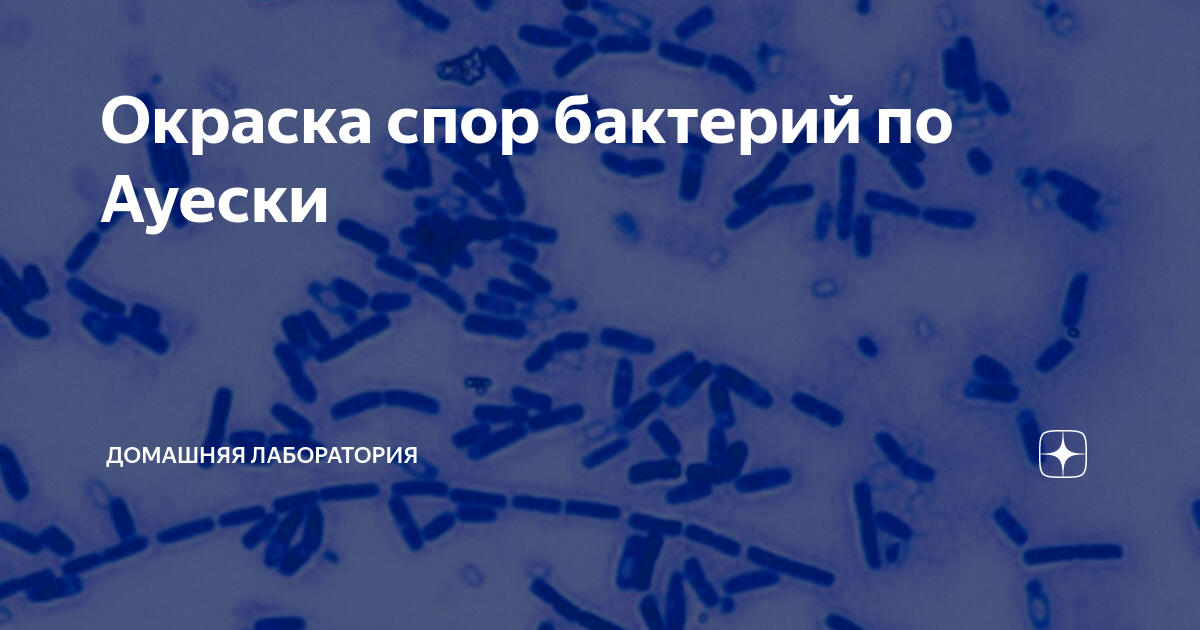 Окраска спор бактерий. Окраска спор по Ауески. Окраска спор микробиология. Метод Ауески окраска.