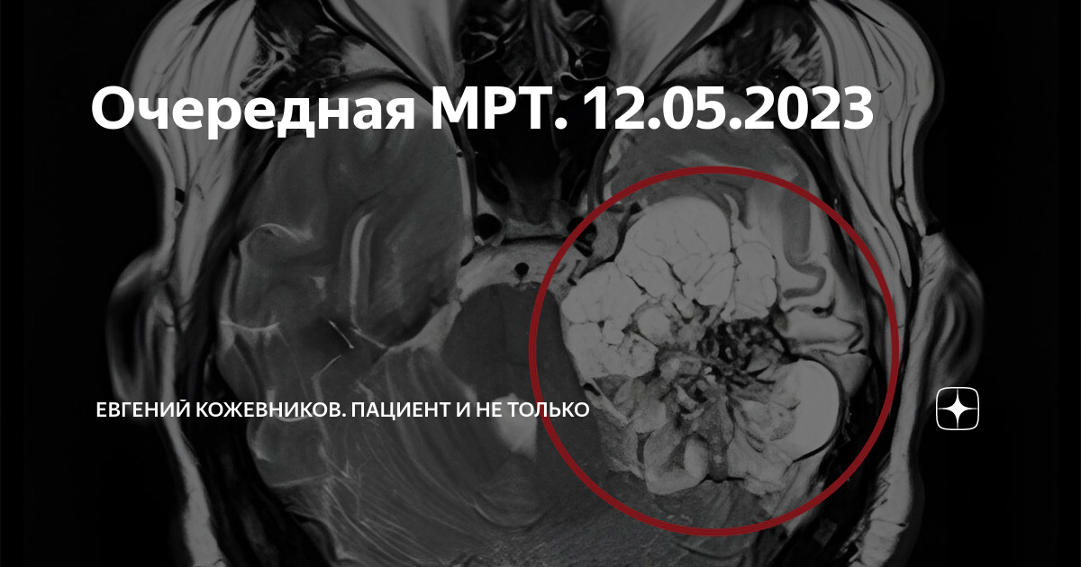 5 тесла. Мрт томограф. Аппарат мрт головы. Любимый м р. Любимый м р.