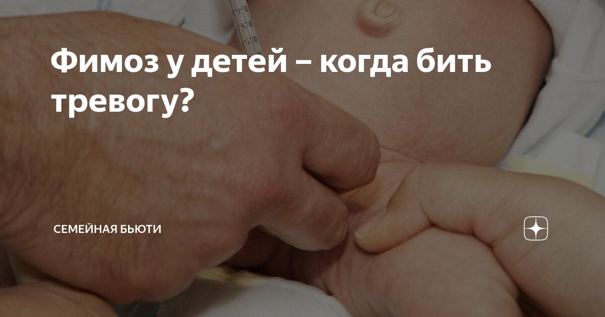 Фимоз симптомы у детей