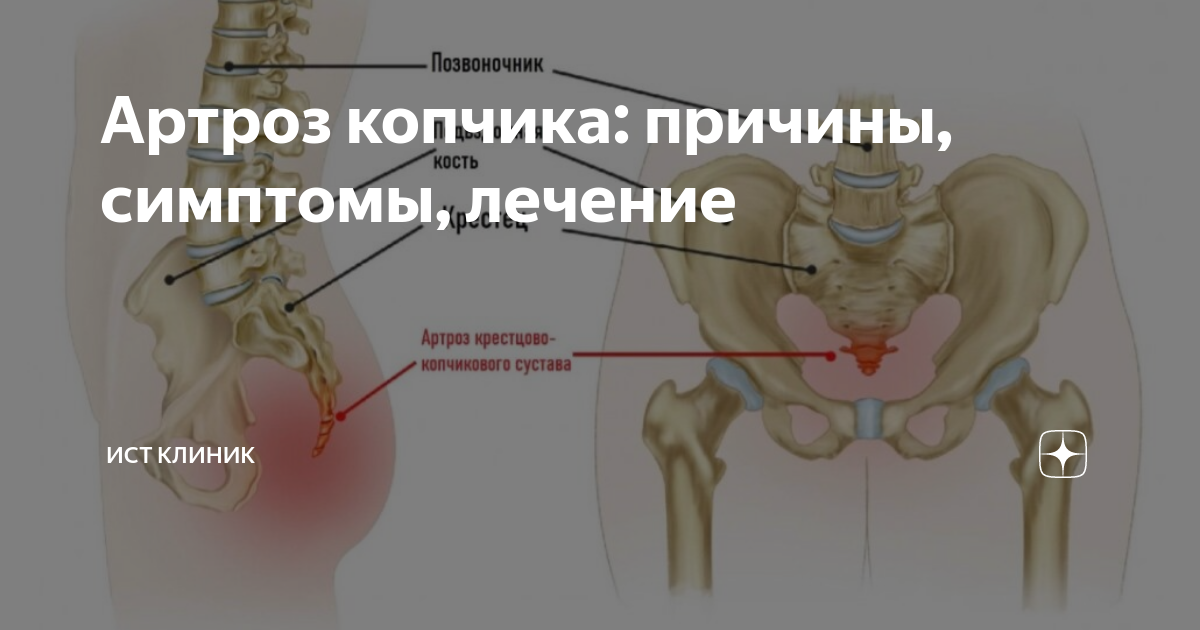 Отделы копчика