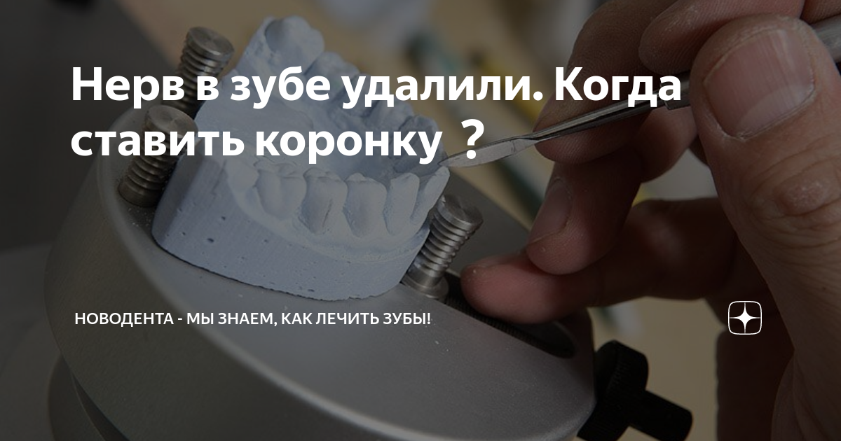 как быстро успокоить нерв в зубе