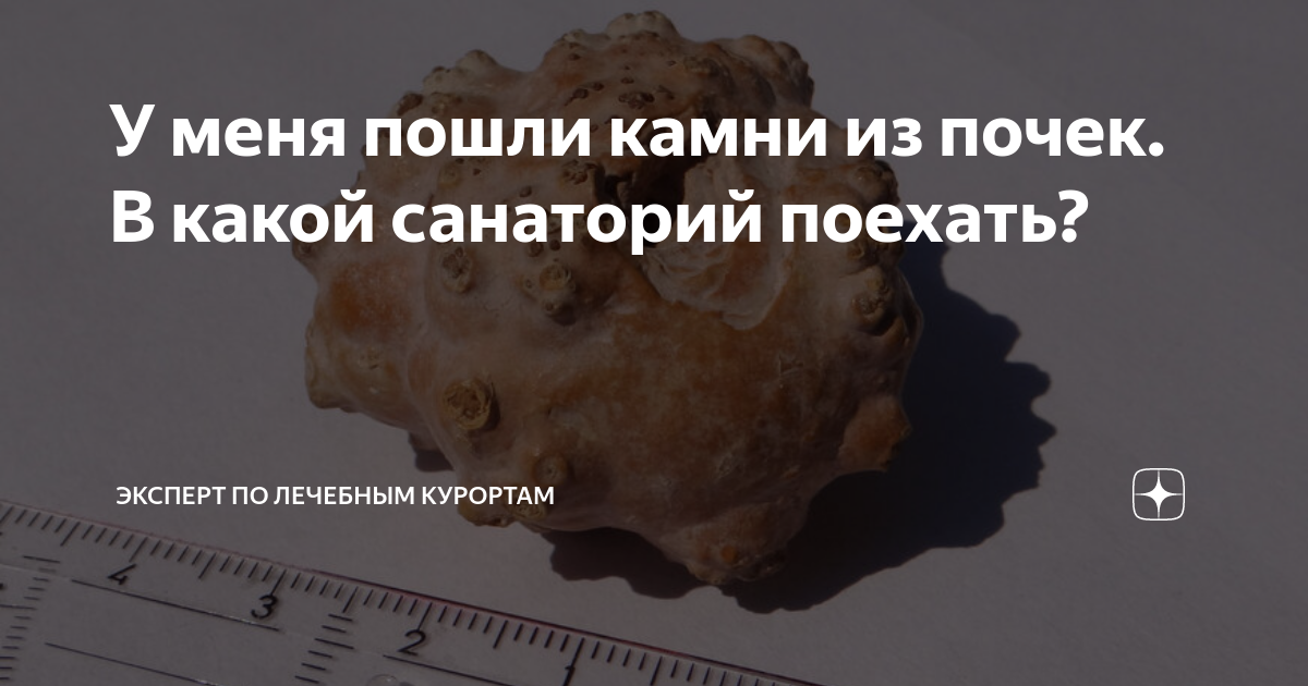 У меня пошли камни из почек. В какой санаторий поехать? | Эксперт по ...