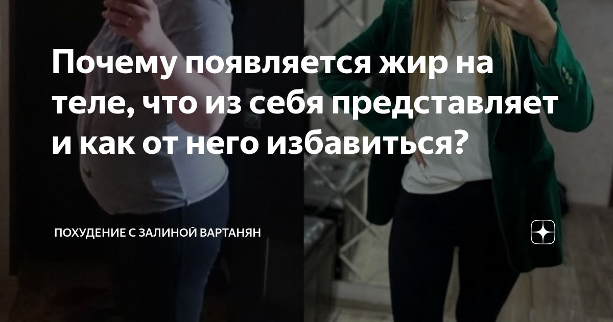 Почему появляется жир на теле, что из себя представляет и как от него ...
