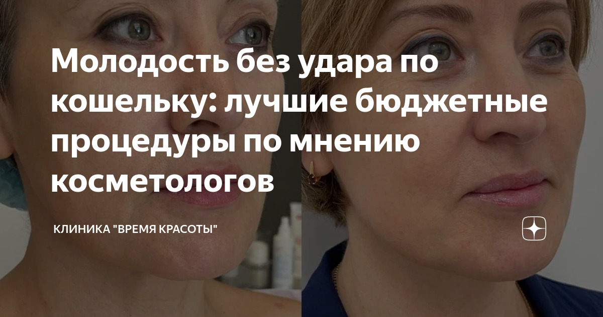 Молодость без удара по кошельку: лучшие бюджетные процедуры по мнению ...