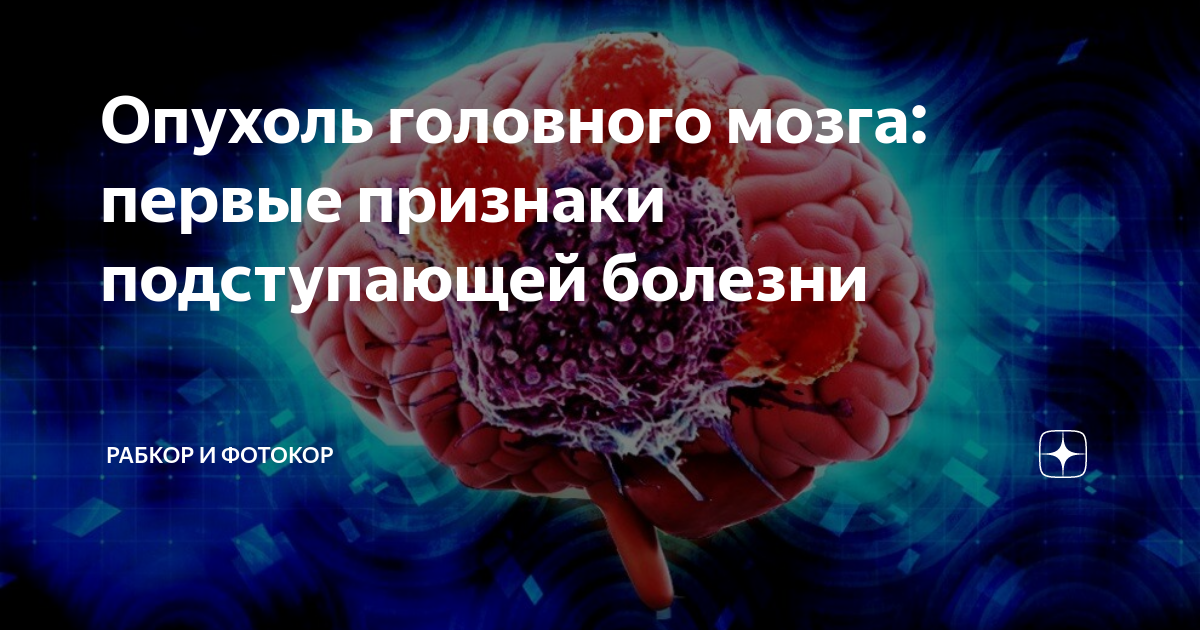 Почему эко вызывает рак головного мозга. Стволовые клетки сердца. Стволовые клетки технология будущего. Клеточные технологии в медицине. Люди с опухолью головного мозга