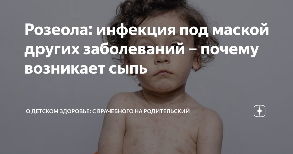 Розеола у малышей: причины инфекции, основные симптомы и лечение MedAboutMe