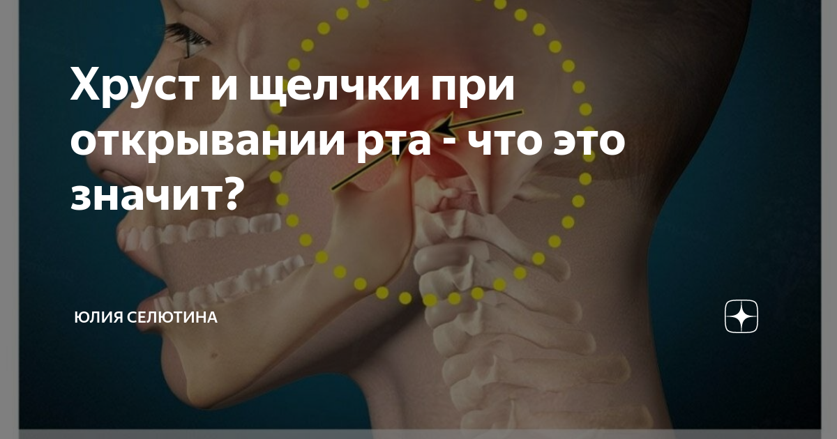 Щелкает челюсть при открывании рта что делать. Хруст в челюсти при открывании. Щелчок в челюсти при открытии. Щелчок при открытии рта. Хруст челюсти при открывании рта.