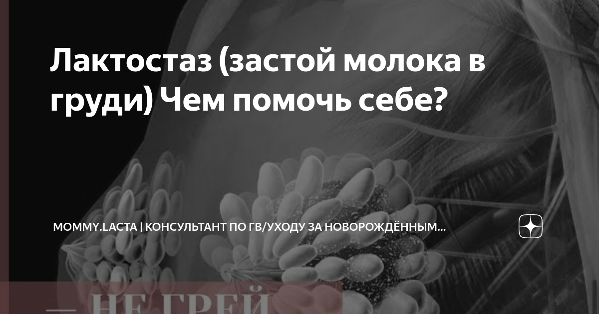 Как остановить лактацию? | Мамолог Бондарь А.В