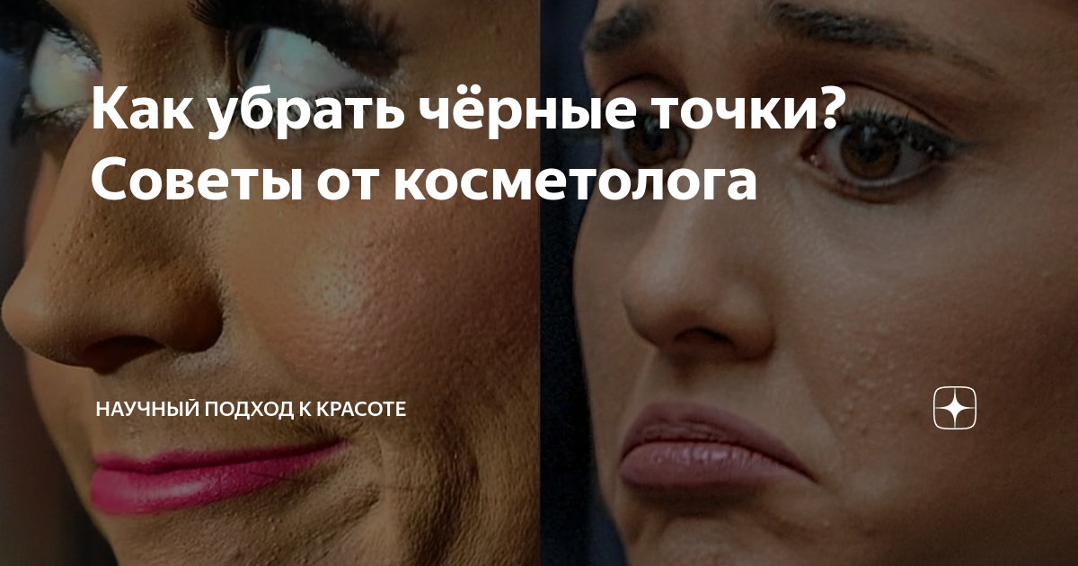 как убрать черные точки