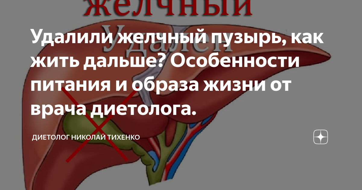 Жидкий стул при удаленном желчном пузыре