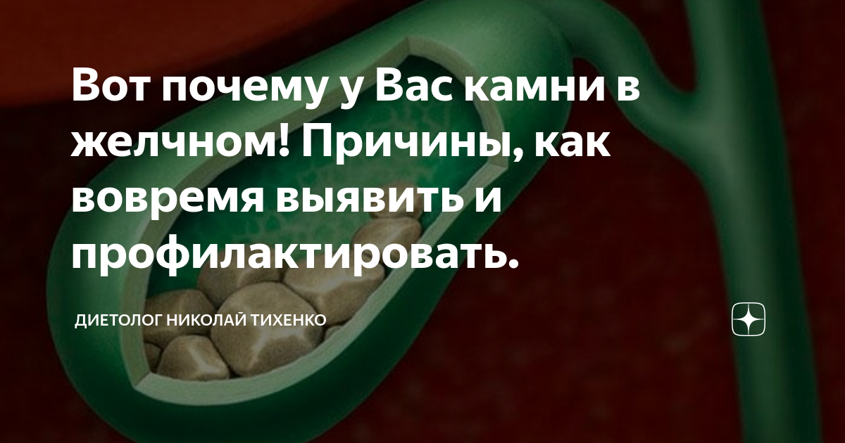 Перегиб желчного питание. Желчный пузырь изогнут. Загиб желчного пузыря. Загиб желчного пузыря симптомы.