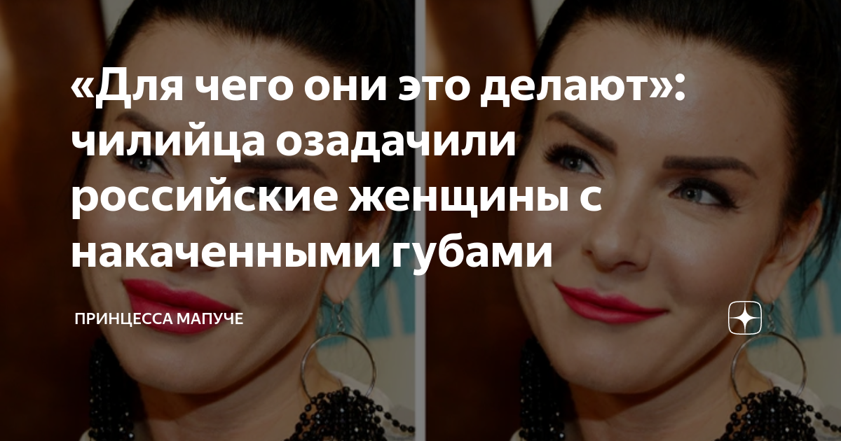 «Каждая вторая – с надутыми губами». Зачем россиянки меняют внешность? - optnp.ru