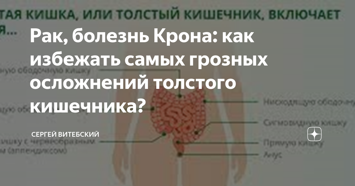 Анализ крови при опухоли кишечника. Методы диагностики опухолей толстого кишечника. Профилактика онкозаболеваний. Анализ на рак толстой кишки. Анализы при опухоли толстой кишки.
