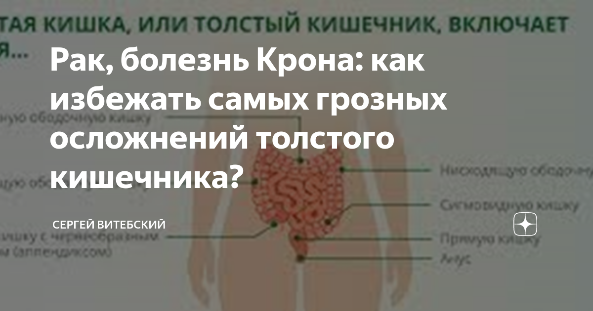 Колоректальный анализ