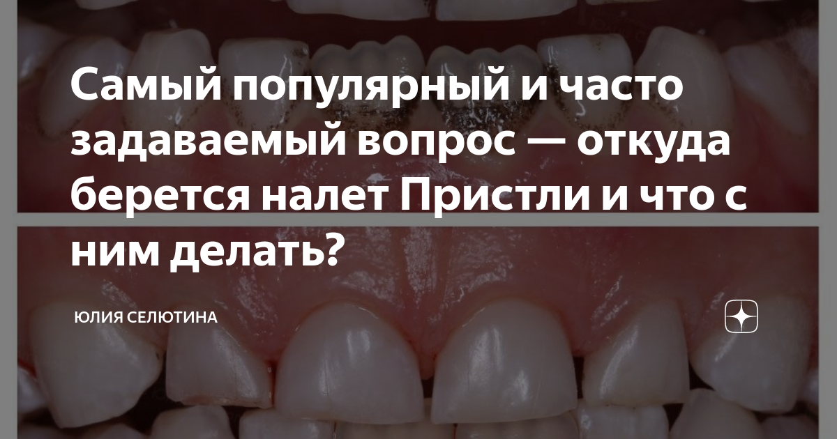 Самый популярный и часто задаваемый вопрос — откуда берется налет ...