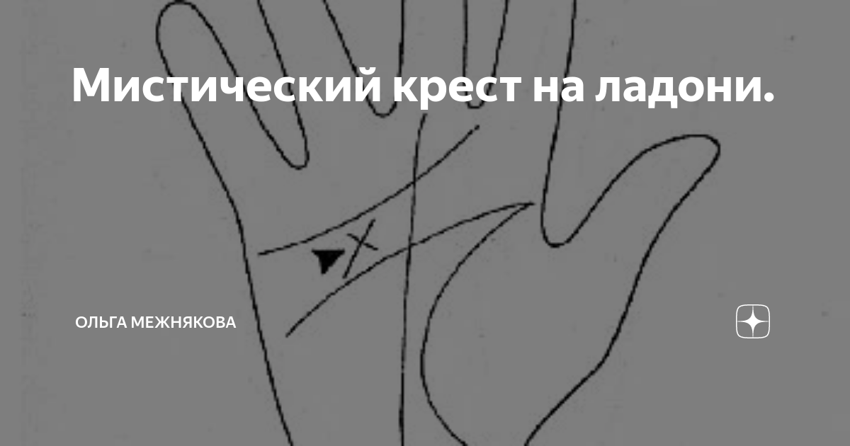 Межнякова хиромант. Межнякова хиромант. Кривой мизинец от телефона. Межнякова хиромант. Межнякова хиромант.