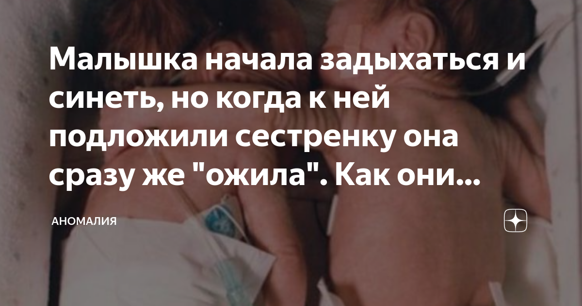 Малышка начала задыхаться и синеть, но когда к ней подложили сестренку ...