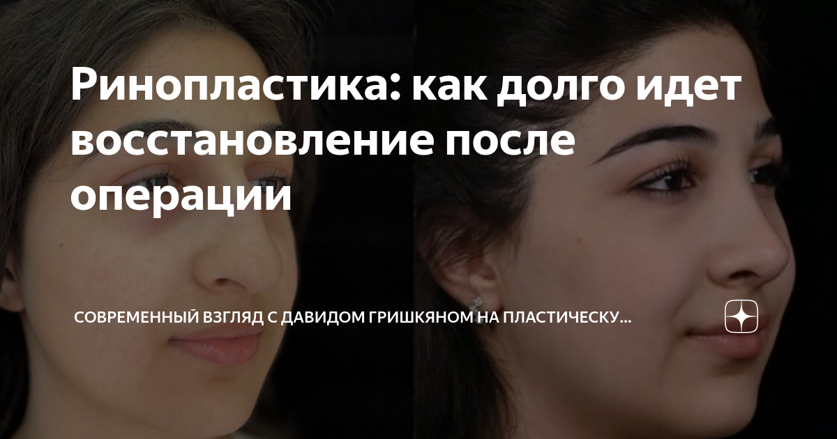 восстановление руки после операции