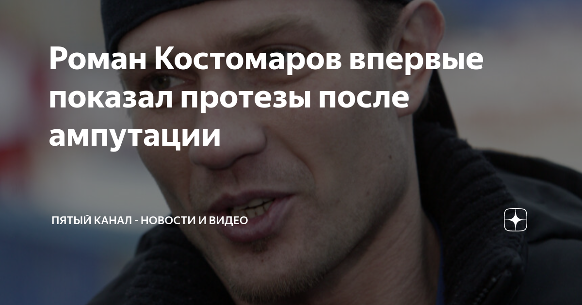 Роман Костомаров впервые показал протезы после ампутации | Пятый канал ...
