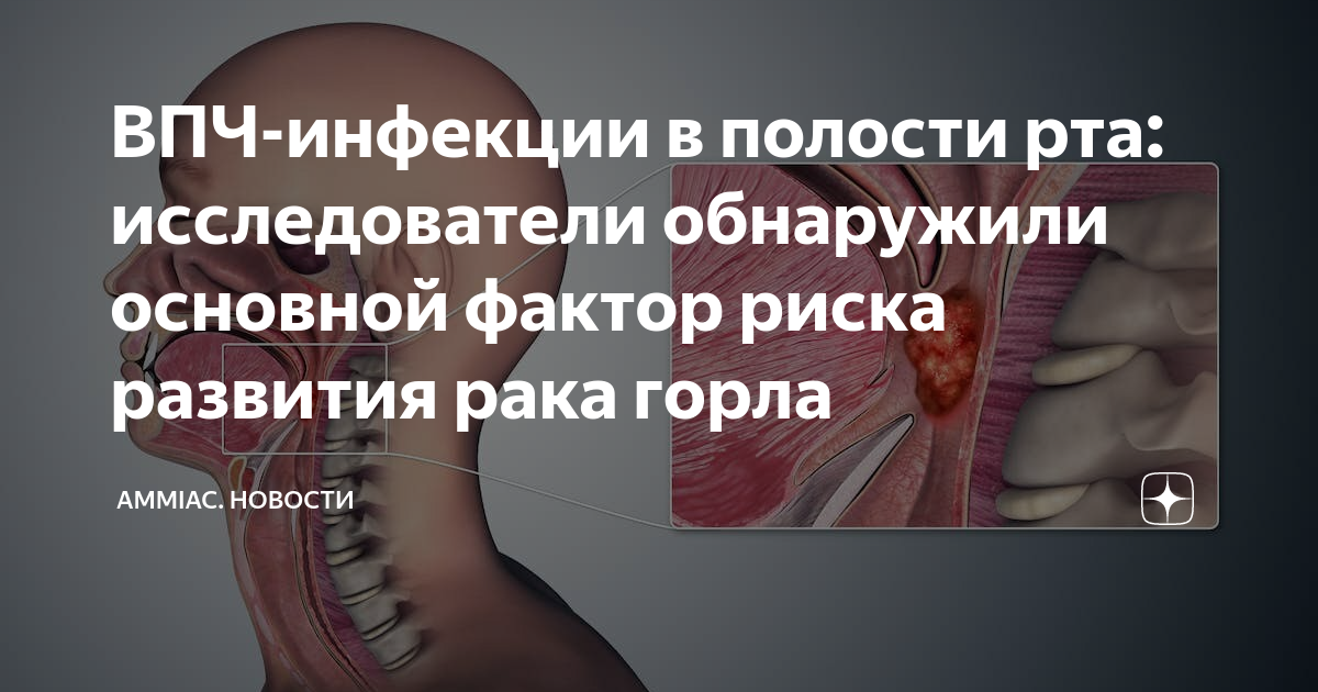 ВПЧ-инфекции в полости рта: исследователи обнаружили основной фактор ...