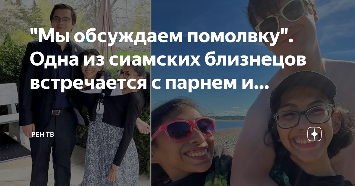 Сиамский близнец мужчина вышел замуж