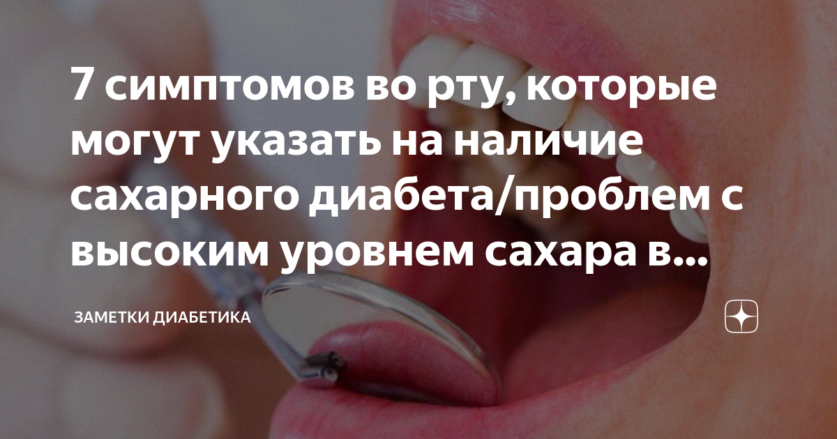 7 симптомов во рту, которые могут указать на наличие сахарного диабета ...