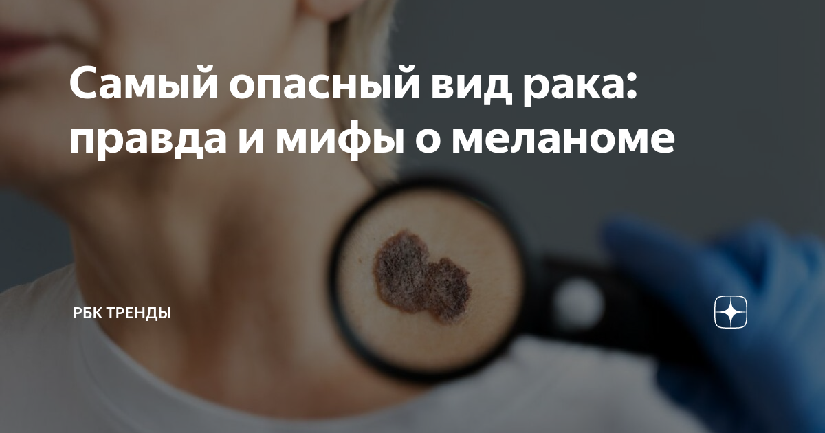 Самый опасный вид рака: правда и мифы о меланоме | РБК Тренды | Дзен