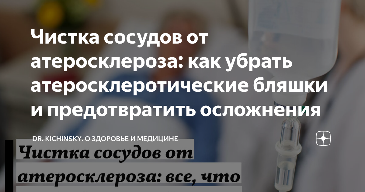 Чистка сосудов от атеросклероза: как убрать атеросклеротические бляшки ...