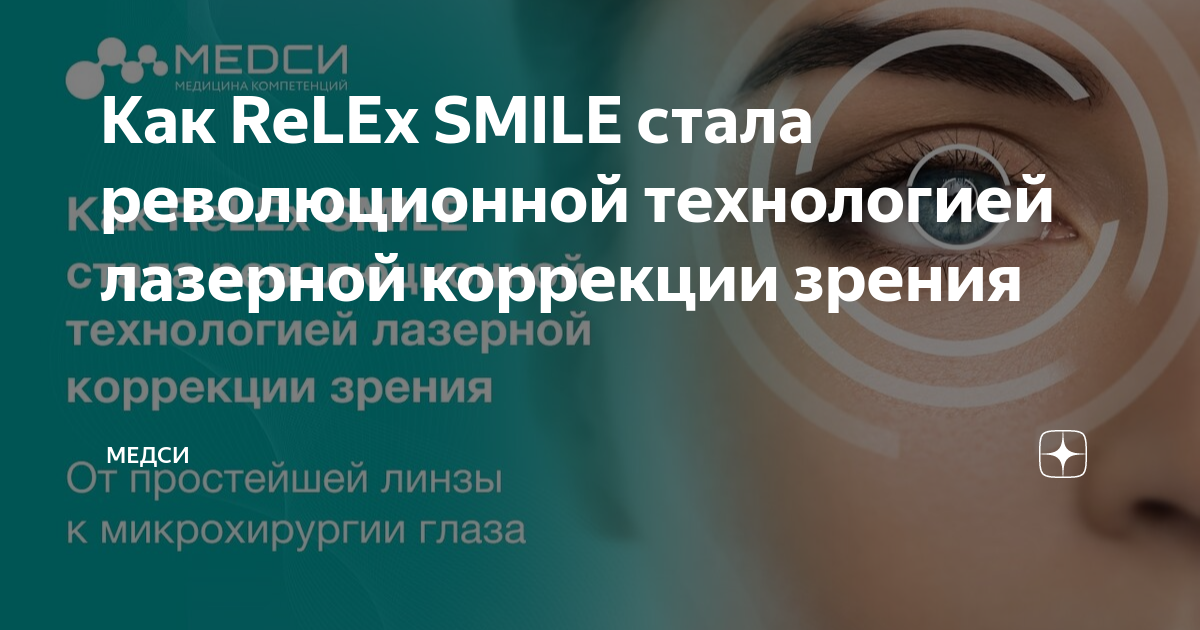 Презентация на тему лазерная коррекция зрения