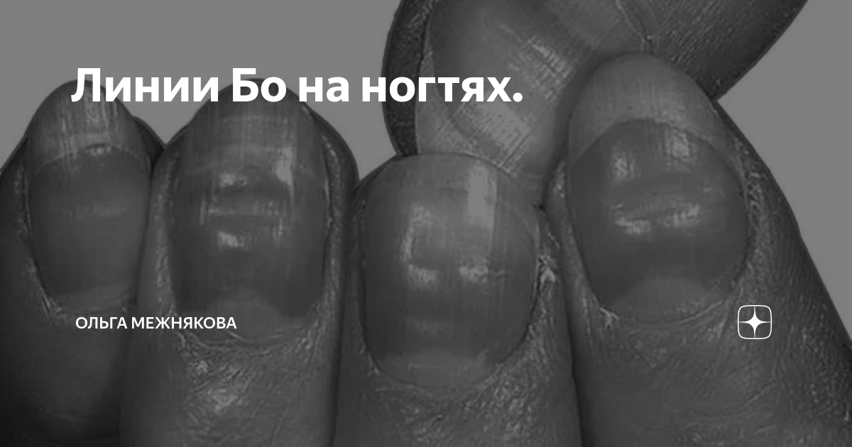 Линия бо фото