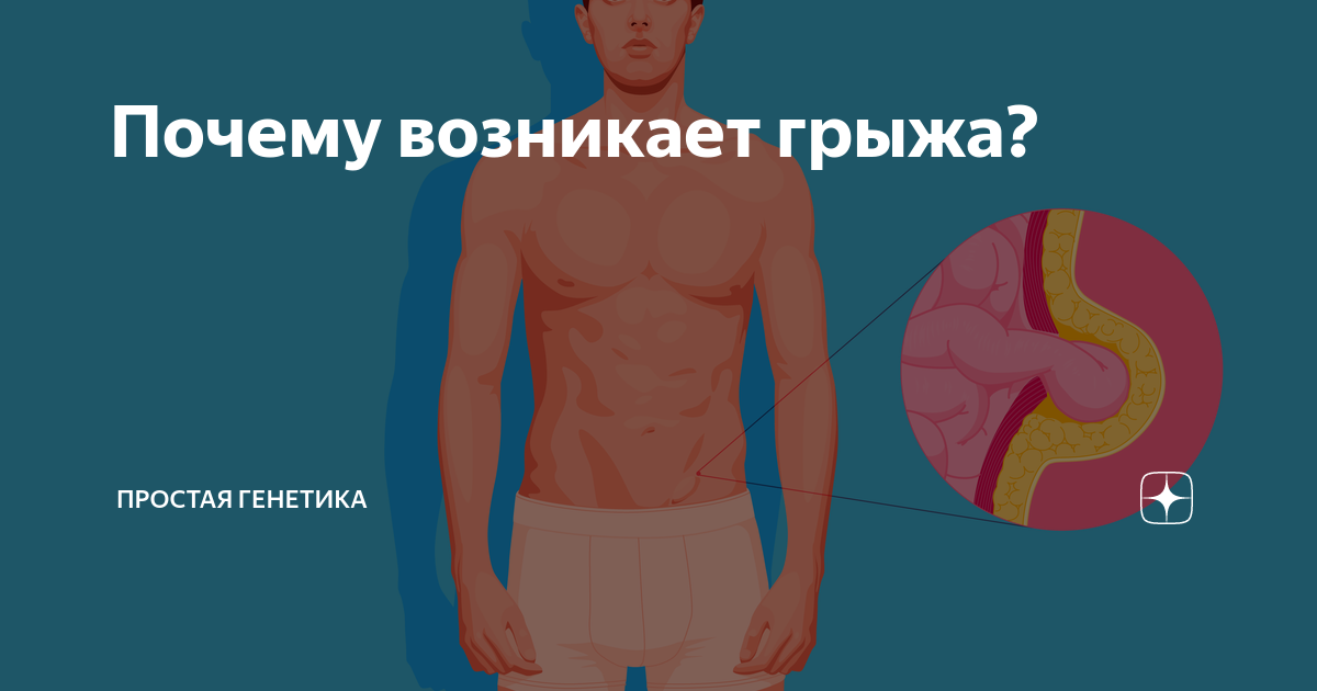 грыжа в пояснице признаки