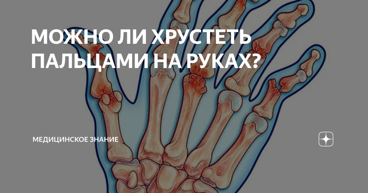 Что будет если хрустеть пальцами