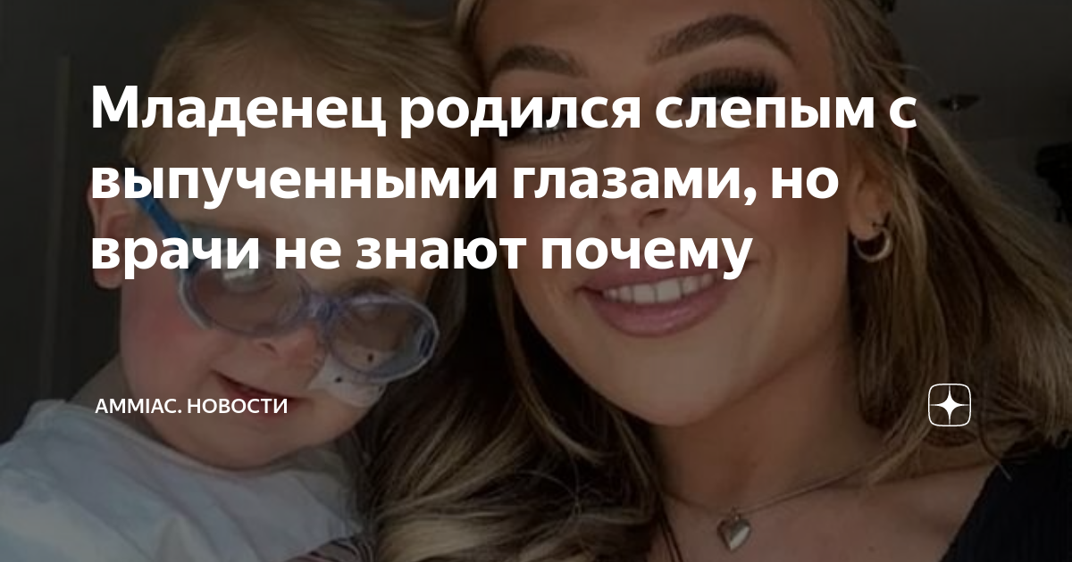 Младенец родился слепым с выпученными глазами, но врачи не знают почему ...