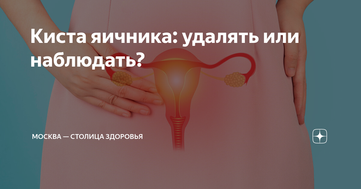 Гистология кисты яичника заключение. Поликистоз узи заключение. Протокол операции киста яичника. Удаление яичников отзывы форум. Удаление яичника последствия.