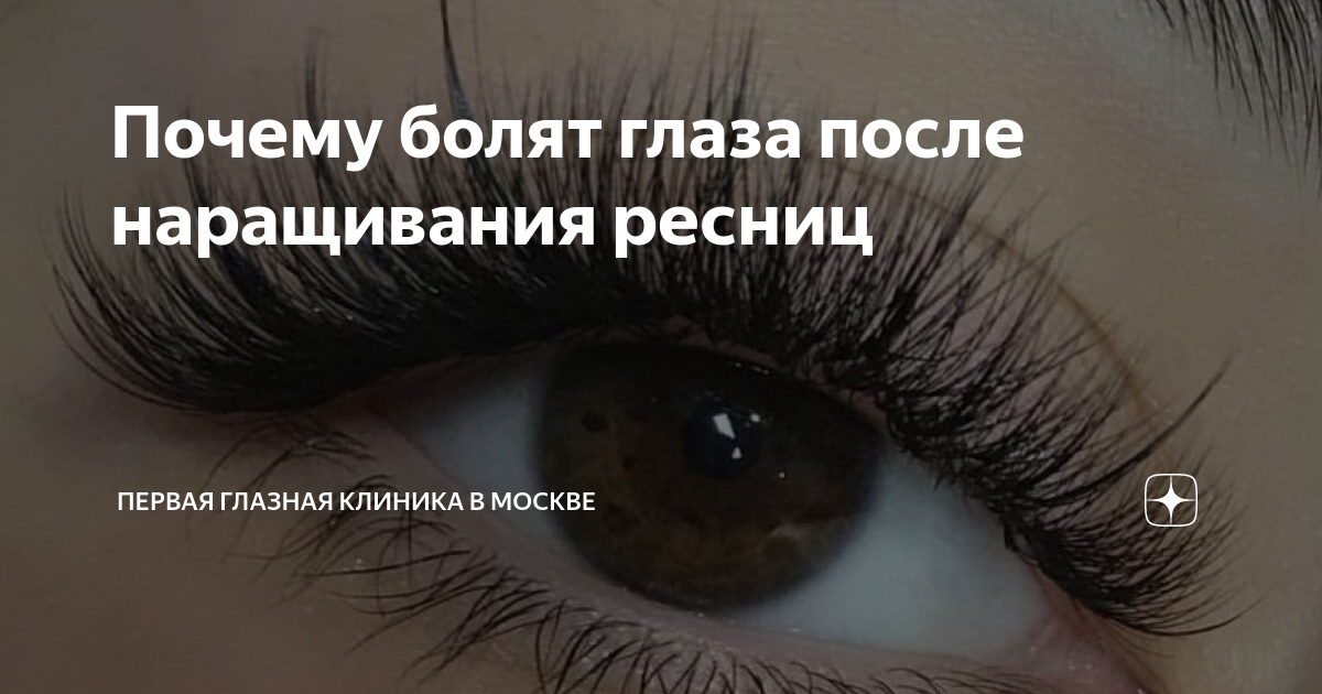 после сна болит глаз