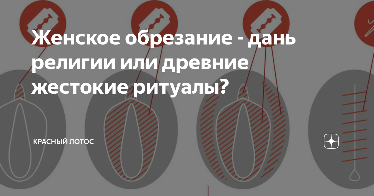 «Открытая рана, натертая солью»: что такое «женское обрезание» и как с ним борются