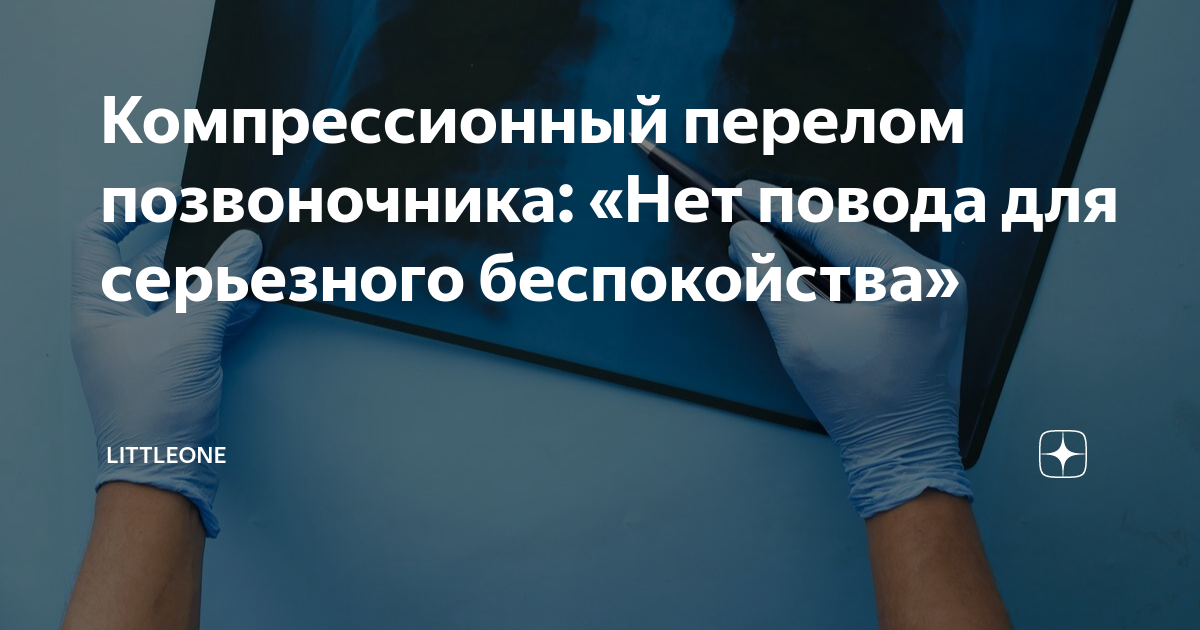 Перелом позвоночника - причины, симптомы, диагностика и лечение компрессионного перелома