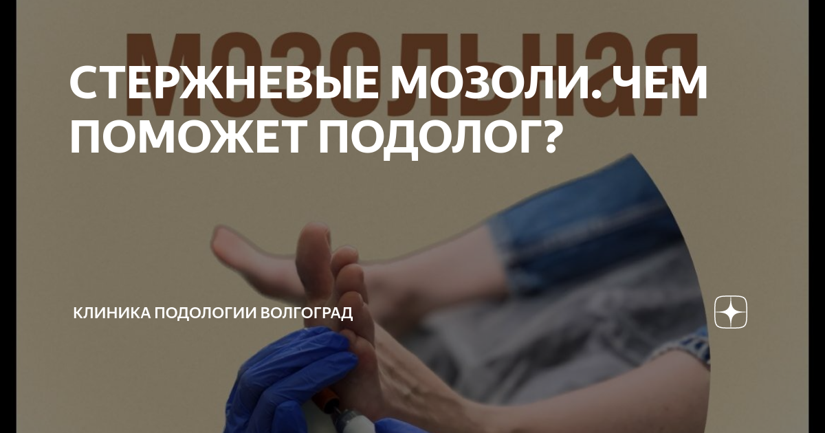 Водяная мозоль - как лечить и что делать? | Лечение мокрой мозоли | KRH Medical в Люберцах