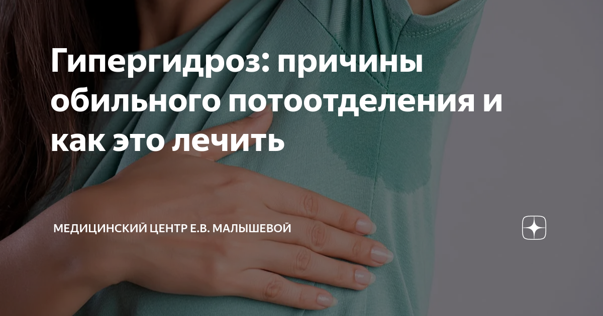 Гипергидроз: причины обильного потоотделения и как это лечить ...