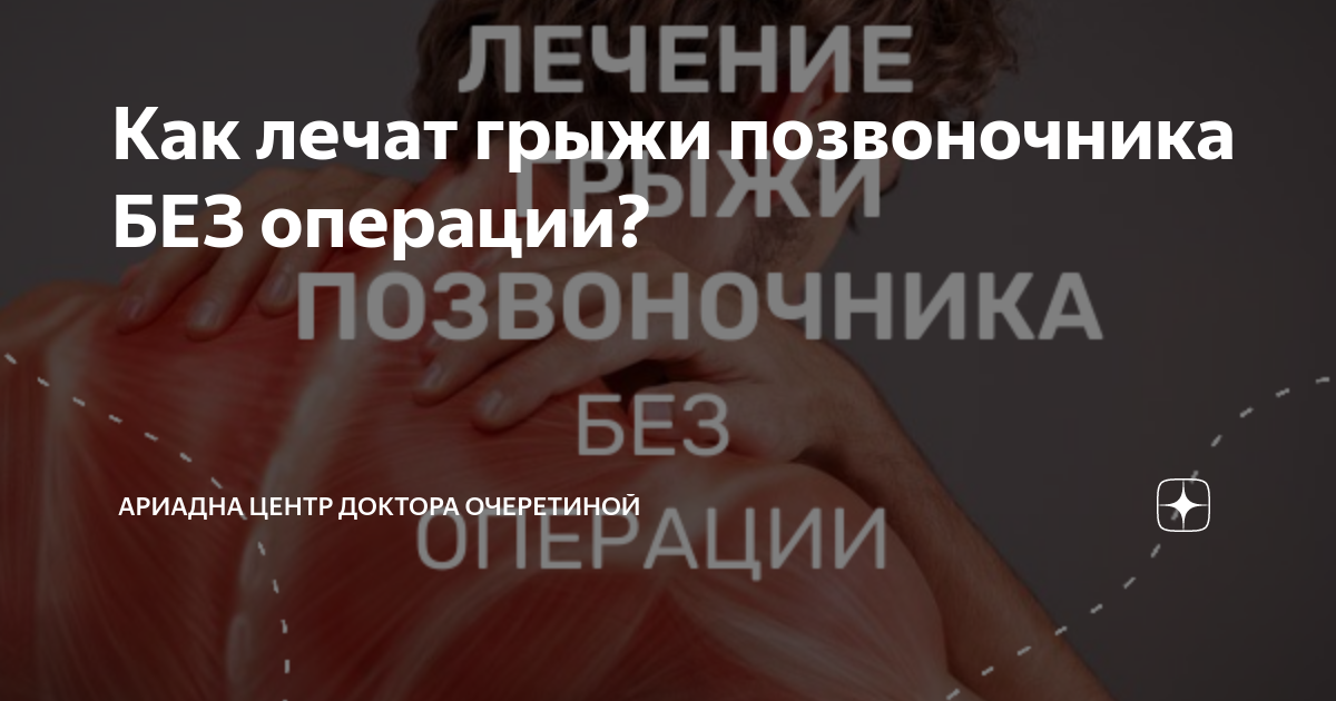 Как лечат грыжи позвоночника БЕЗ операции? | Ариадна центр доктора ...