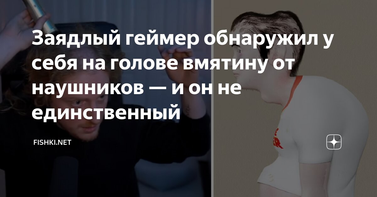 у меня в голове психушка