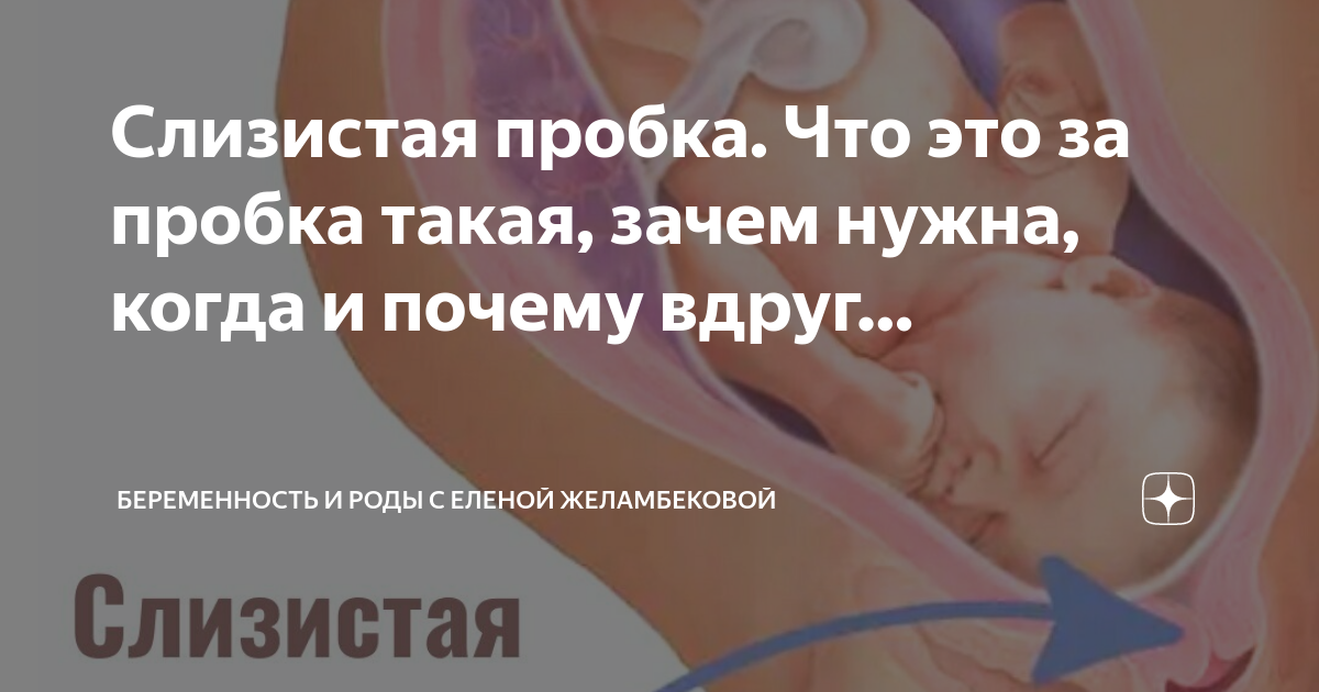 Фотографии ОТХОДИТ ПРОБКА РОДЫ ВТОРАЯ