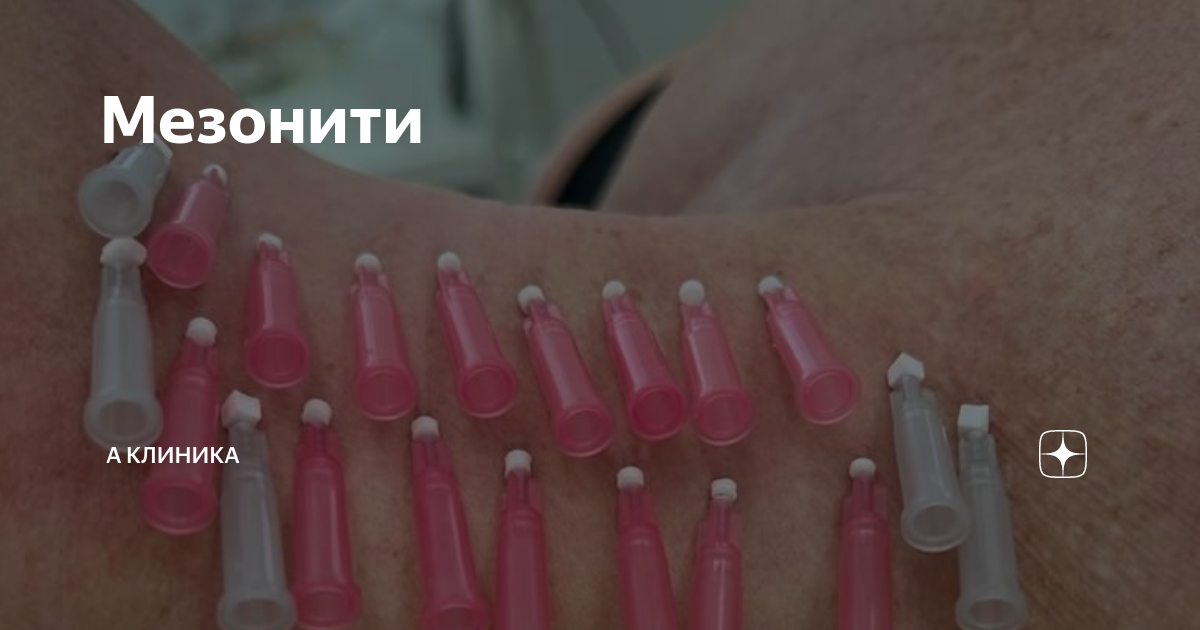 мезонити рекомендации после процедуры