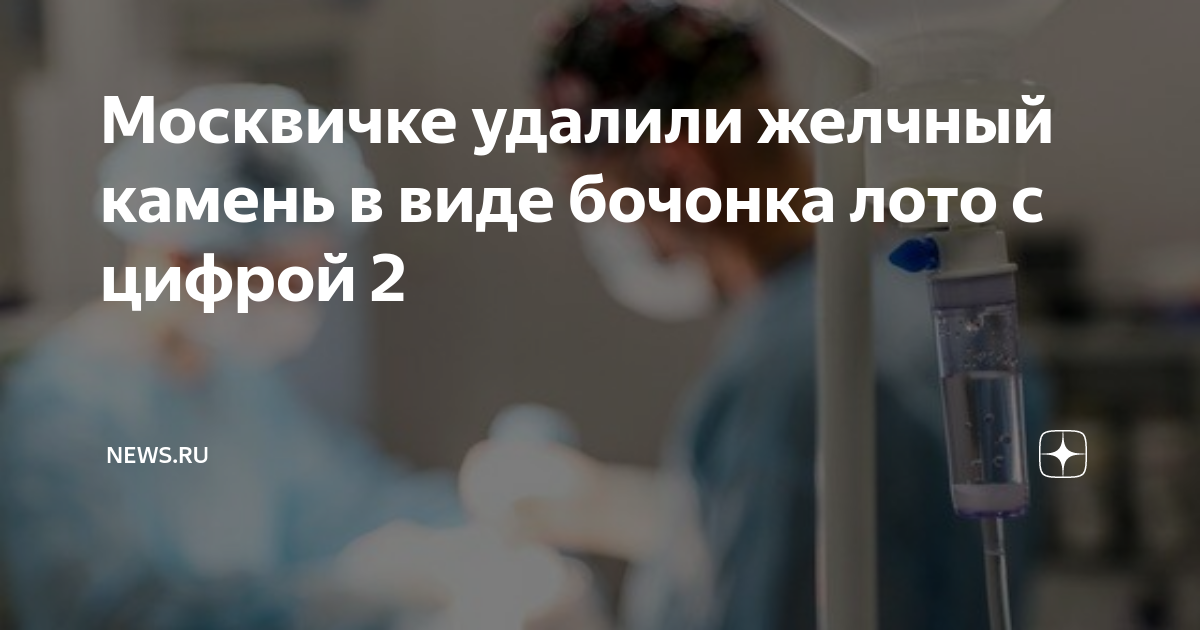 Москвичке удалили желчный камень в виде бочонка лото с цифрой 2 | NEWS ...
