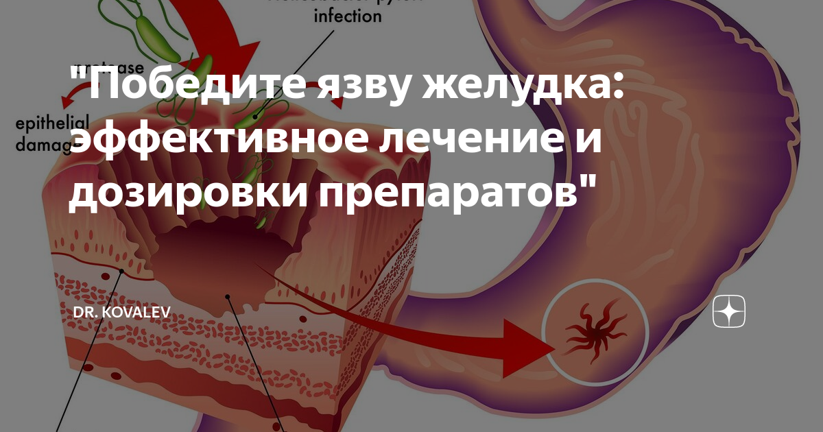 Масло для желудка при язве. Винилин (бальзам шостаковского) 50г. Чем полезно оливковое масло. Какое масло при язве желудка. Облепиховое масло при язве желудка.