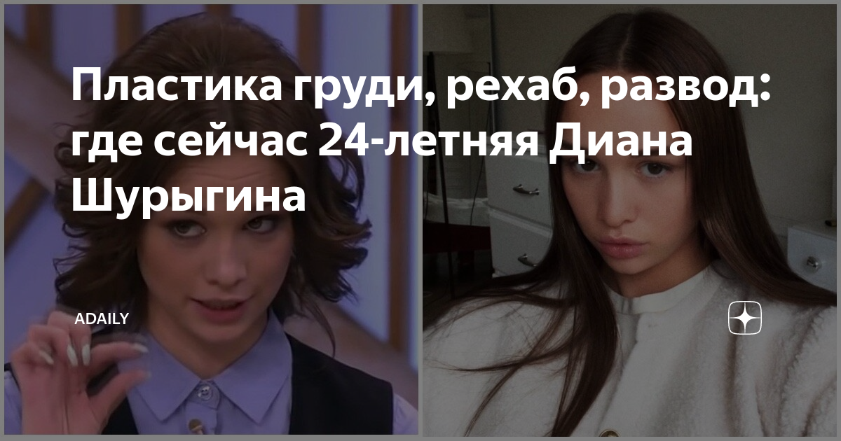 Пластика груди, рехаб, развод: где сейчас 24-летняя Диана Шурыгина ...