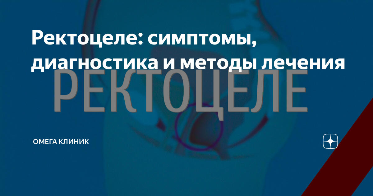 ректоцеле восстановление после операции