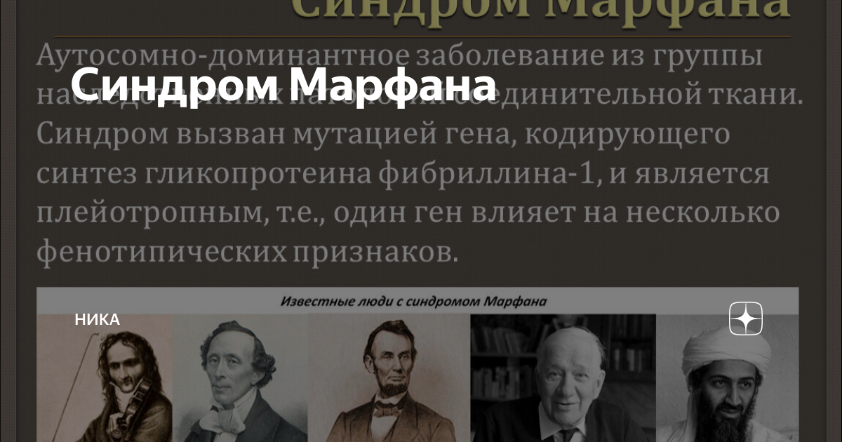 Синдром Марфана | Ника | Дзен